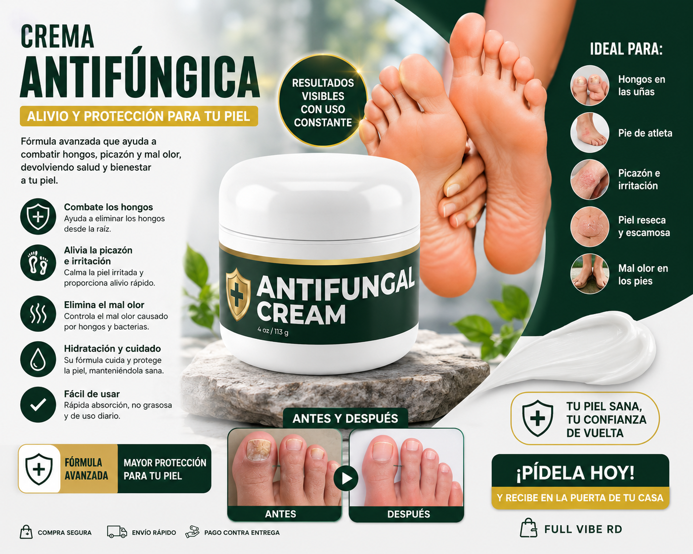 Crema Antifúngica para Piel y Uñas | Alivio de Hongos, Picazón y Mal Olor.